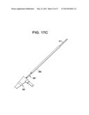 SYSTEMS AND METHODS FOR PUNCTURE CLOSURE diagram and image