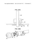 SYSTEMS AND METHODS FOR PUNCTURE CLOSURE diagram and image