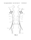 METHOD OF CONTINUOUS CASTING THIN STEEL STRIP diagram and image