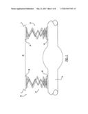 THREE-STAGE CONCENTRIC COIL SPRING SYSTEM diagram and image