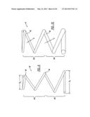 THREE-STAGE CONCENTRIC COIL SPRING SYSTEM diagram and image