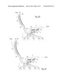 Seat Having A Backrest Which Can Be Adjusted To Form A Precurved     Deformation diagram and image