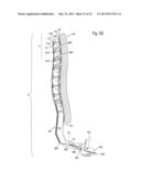 Seat Having A Backrest Which Can Be Adjusted To Form A Precurved     Deformation diagram and image