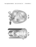 COMPACT, ENERGY-EFFICIENT ULTRASOUND IMAGING PROBES USING CMUT ARRAYS WITH     INTEGRATED ELECTRONICS diagram and image