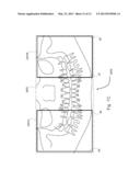 PANORAMIC DENTAL X-RAY UNIT diagram and image