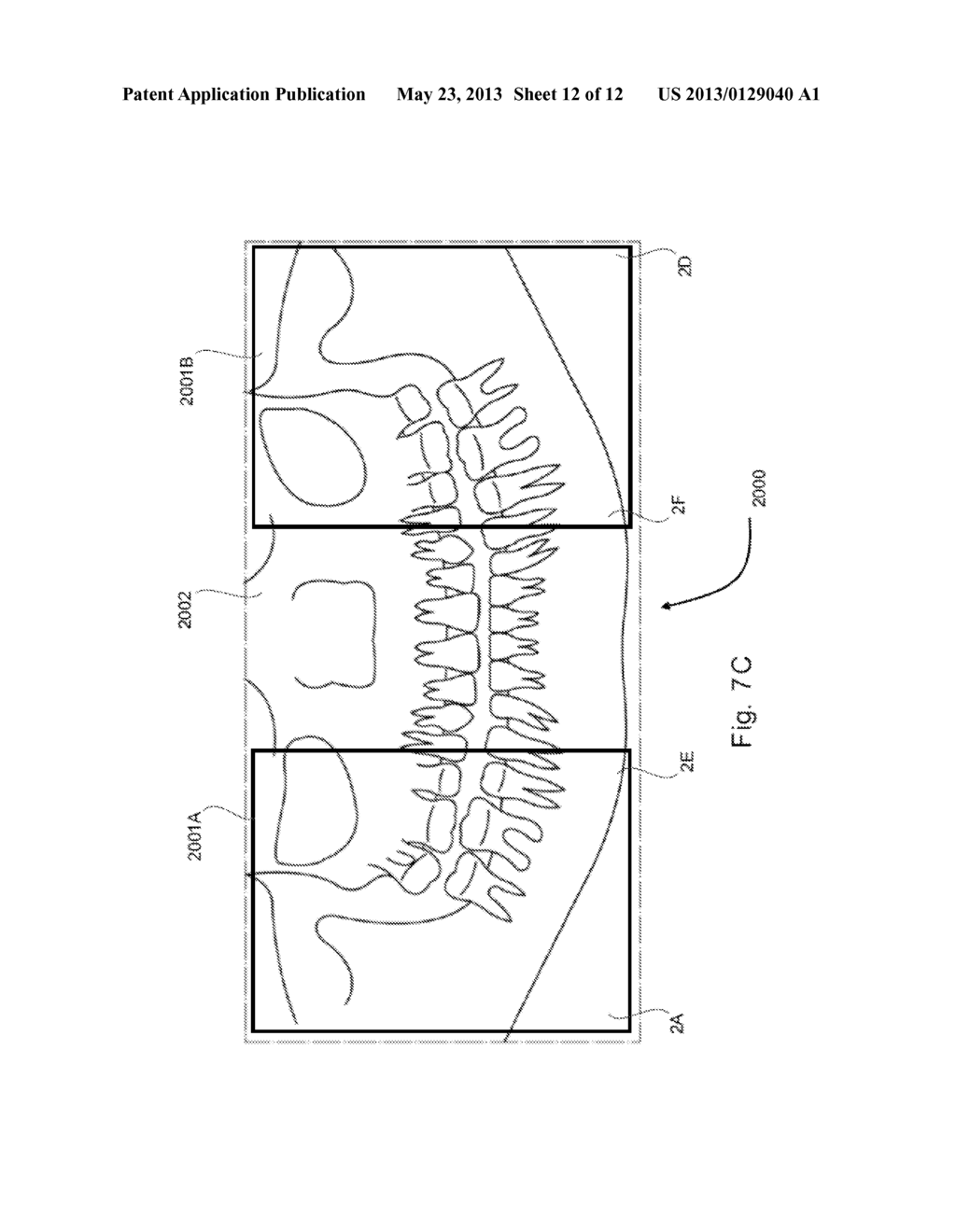 PANORAMIC DENTAL X-RAY UNIT - diagram, schematic, and image 13