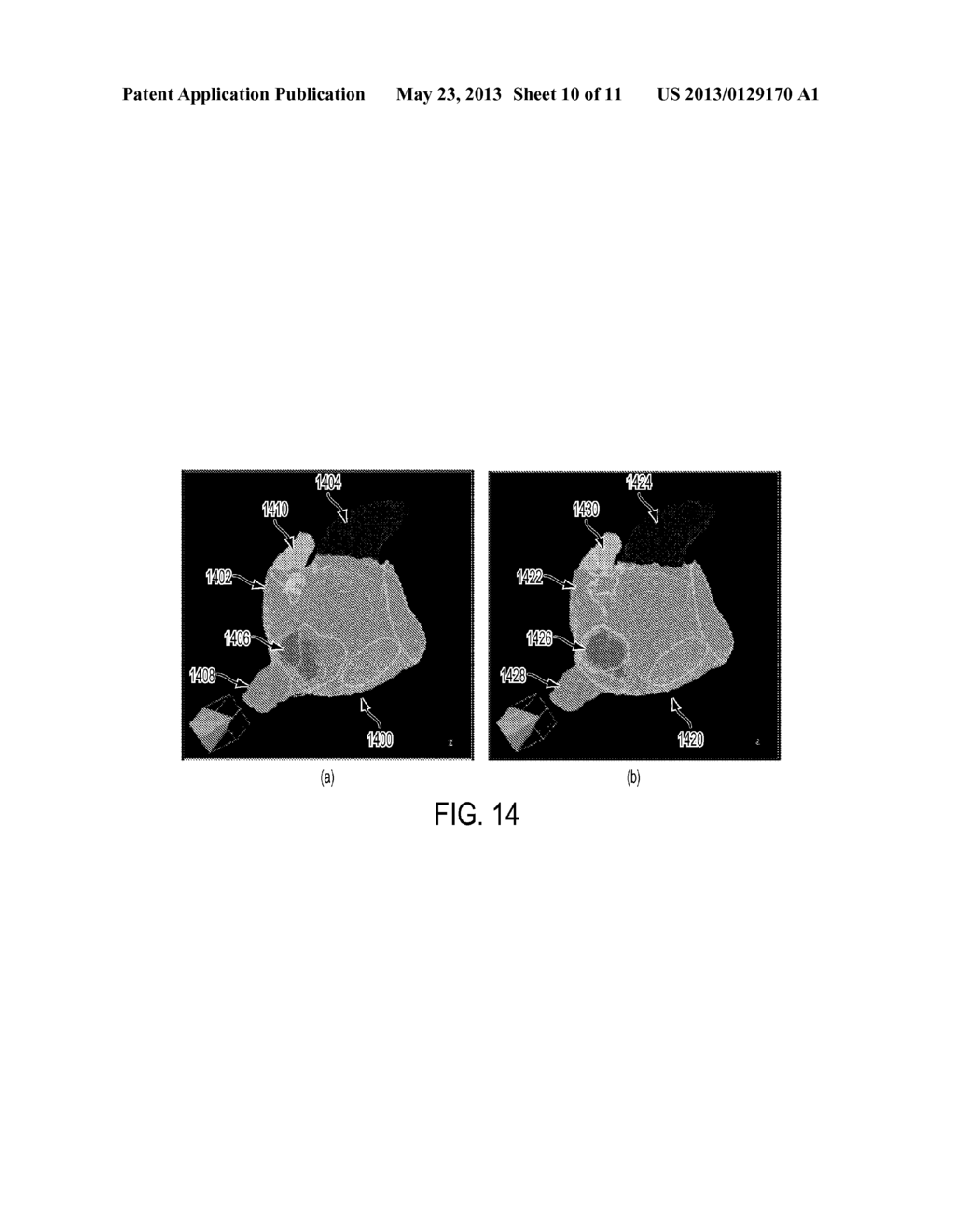 Method and System for Precise Segmentation of the Left Atrium in C-Arm     Computed Tomography Volumes - diagram, schematic, and image 11