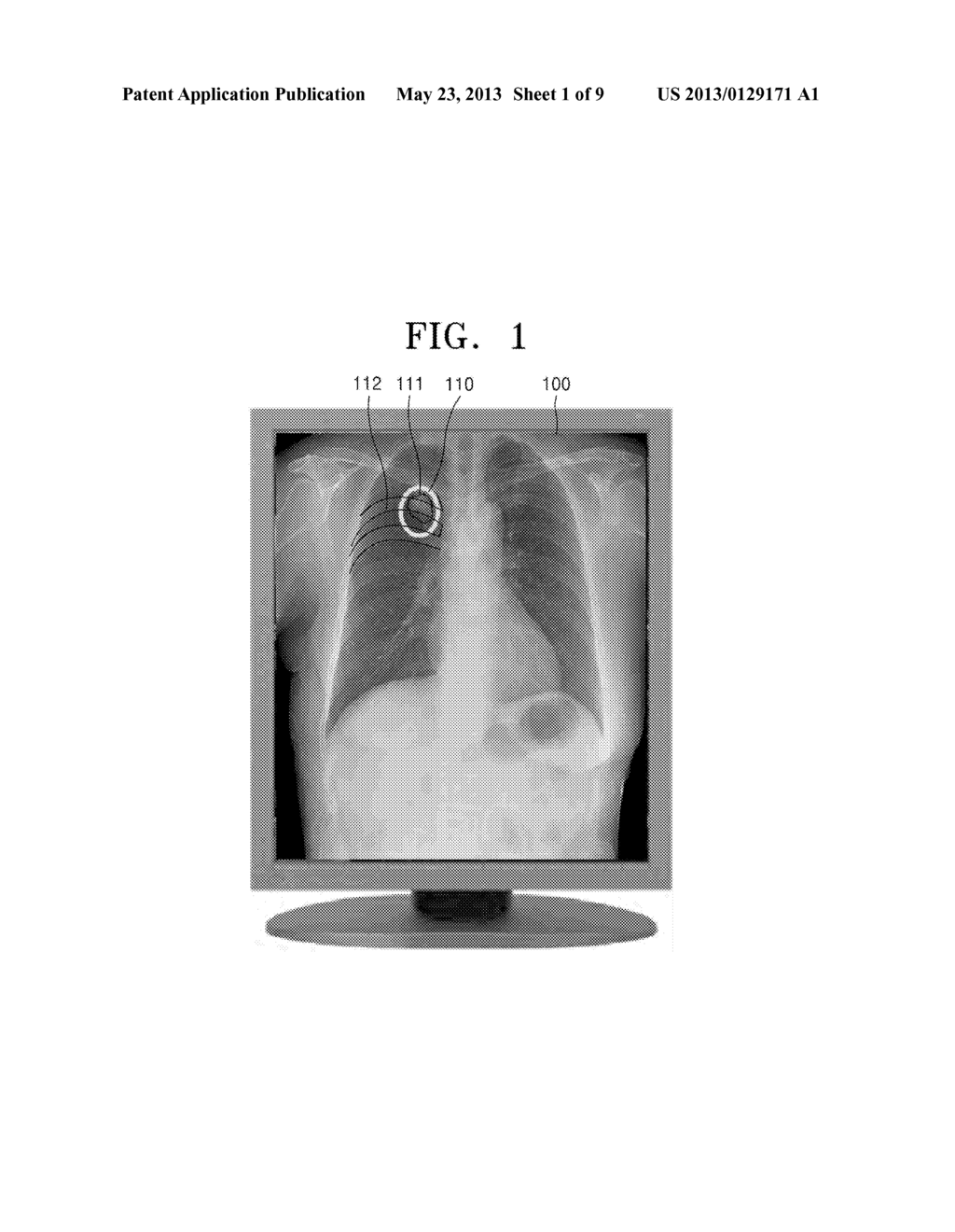 COMPUTER-AIDED DIAGNOSIS METHOD AND COMPUTER-AIDED DIAGNOSIS APPARATUS     THEREFOR - diagram, schematic, and image 02