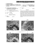 Method for Pan-Sharpening Panchromatic and Multispectral Images Using     Dictionaries diagram and image