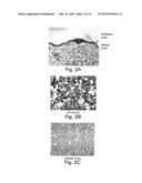 Compositions For The Treatment Of Skin Conditions, Disorders Or Diseases     And Methods Of Making And Using The Same diagram and image