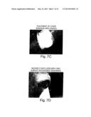 Compositions For The Treatment Of Skin Conditions, Disorders Or Diseases     And Methods Of Making And Using The Same diagram and image