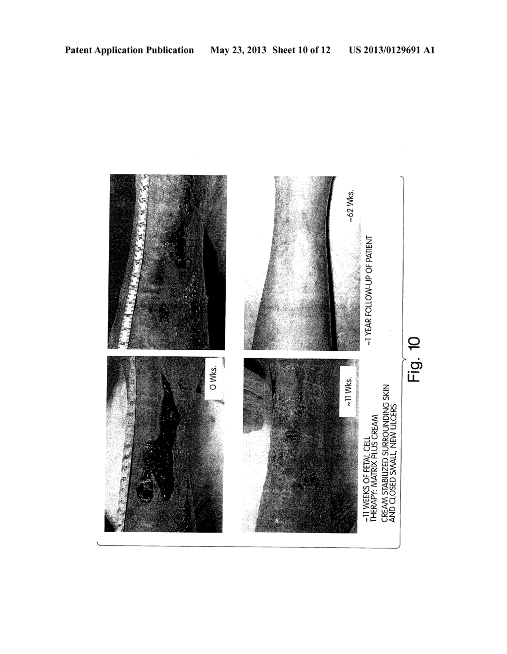 Compositions For The Treatment Of Skin Conditions, Disorders Or Diseases     And Methods Of Making And Using The Same - diagram, schematic, and image 11