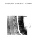 ANTI-FRETTING WEAR COATING FOR SUBSTRATES diagram and image