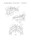 ORAL ORTHOSIS HANDLE diagram and image