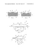 ORAL ORTHOSIS HANDLE diagram and image