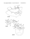 ORAL ORTHOSIS HANDLE diagram and image