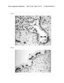 Novel genes and uses thereof, expression profile of colon, gastric and     pancreatic cancer diagram and image