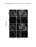 METHOD FOR GENERATING INDUCED PLURIPOTENT STEM CELLS FROM KERATINOCYTES     DERIVED FROM PLUCKED HAIR FOLLICLES diagram and image