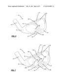 GOLF CLUB WITH A SUPPORT BRACKET diagram and image