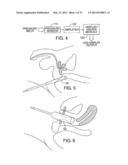 Pelvic Muscle Trainer diagram and image