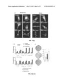 BIOMARKER FOR THE DIAGNOSIS, PROGNOSIS AND MONITORING OF CANCER diagram and image