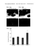 TREATMENT OF DIABETES AND DISORDERS ASSOCIATED WITH VISCERAL OBESITY WITH     INHIBITORS OF HUMAN ARACHIDONATE 12 LIPOXYGENASE AND ARACHIDONATE     15-LIPOXYGENASE diagram and image