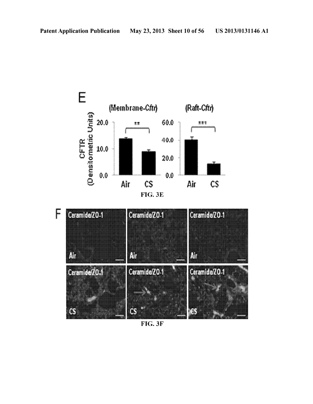 Compositions and Methods for Treating Pulmonary Conditions - diagram, schematic, and image 11