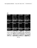 Compositions and Methods for Treating Pulmonary Conditions diagram and image