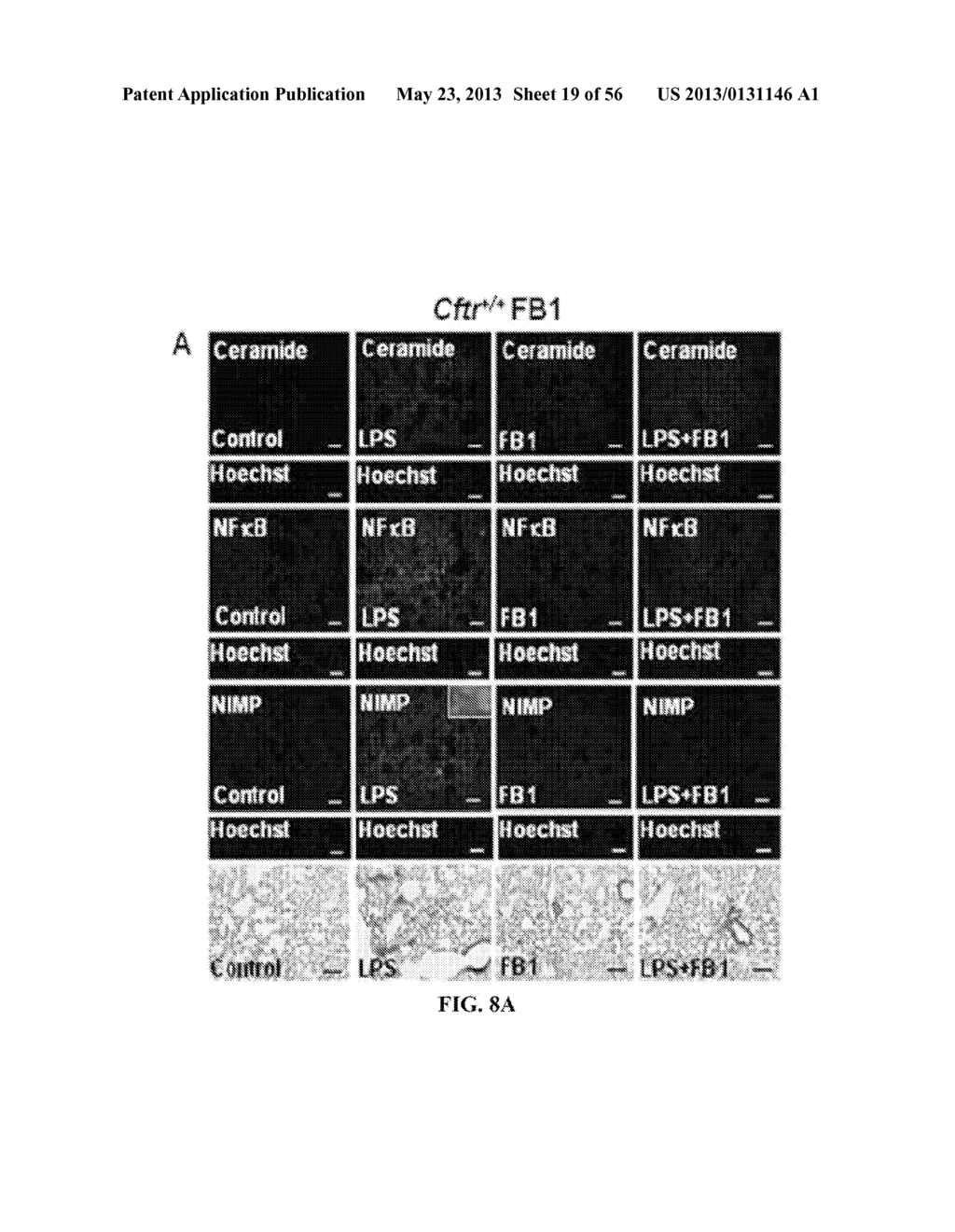 Compositions and Methods for Treating Pulmonary Conditions - diagram, schematic, and image 20