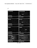 Compositions and Methods for Treating Pulmonary Conditions diagram and image