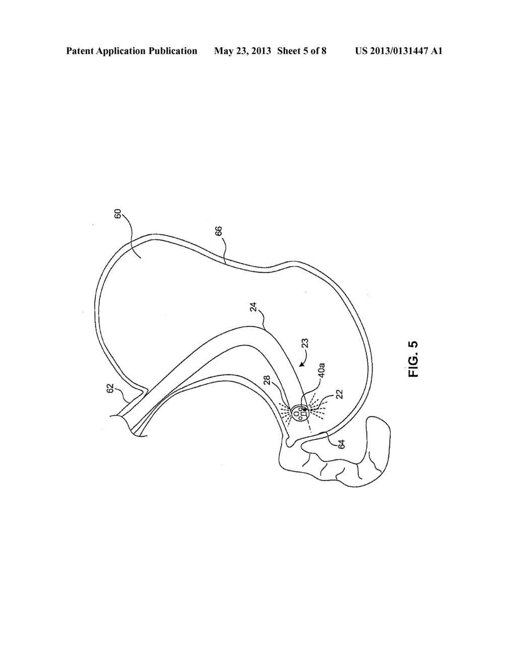 ENDOSCOPIC SYSTEM FOR OPTIMIZED VISUALIZATION - diagram, schematic, and image 06