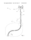 ENDOSCOPE STABILIZATION SYSTEM diagram and image