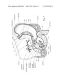 ENDOSCOPE STABILIZATION SYSTEM diagram and image