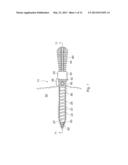 MEDICAL CANNULA ASSEMBLY diagram and image