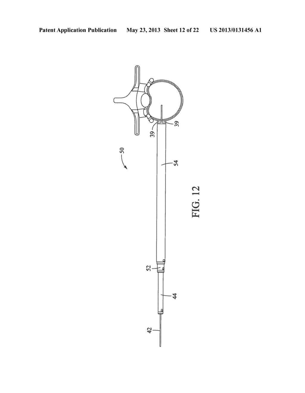 Surgical Access System and Related Methods - diagram, schematic, and image 13