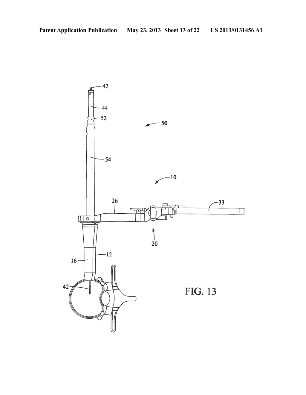 Surgical Access System and Related Methods - diagram, schematic, and image 14