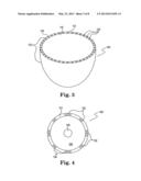 DEVICE AND METHOD FOR ILLUMINATION OF VAGINAL FORNIX WITH URETER LOCATION,     ISOLATION AND PROTECTION DURING HYSTERECTOMY PROCEDURE diagram and image