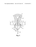 DEVICE AND METHOD FOR ILLUMINATION OF VAGINAL FORNIX WITH URETER LOCATION,     ISOLATION AND PROTECTION DURING HYSTERECTOMY PROCEDURE diagram and image