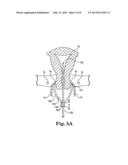 DEVICE AND METHOD FOR ILLUMINATION OF VAGINAL FORNIX WITH URETER LOCATION,     ISOLATION AND PROTECTION DURING HYSTERECTOMY PROCEDURE diagram and image