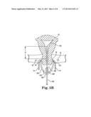 DEVICE AND METHOD FOR ILLUMINATION OF VAGINAL FORNIX WITH URETER LOCATION,     ISOLATION AND PROTECTION DURING HYSTERECTOMY PROCEDURE diagram and image