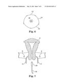 DEVICE AND METHOD FOR ILLUMINATION OF VAGINAL FORNIX WITH URETER LOCATION,     ISOLATION AND PROTECTION DURING HYSTERECTOMY PROCEDURE diagram and image