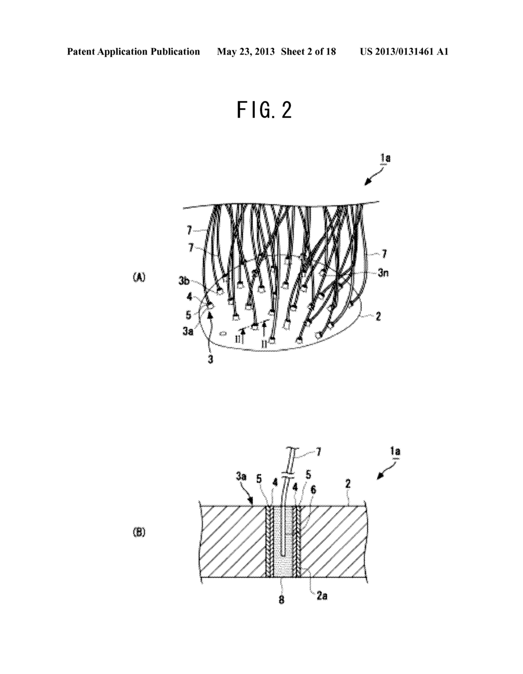 ELECTROENCEPHALOGRAM ELECTRODE UNIT FOR SMALL ANIMALS AND MEASUREMENT     SYSTEM USING THE SAME - diagram, schematic, and image 03