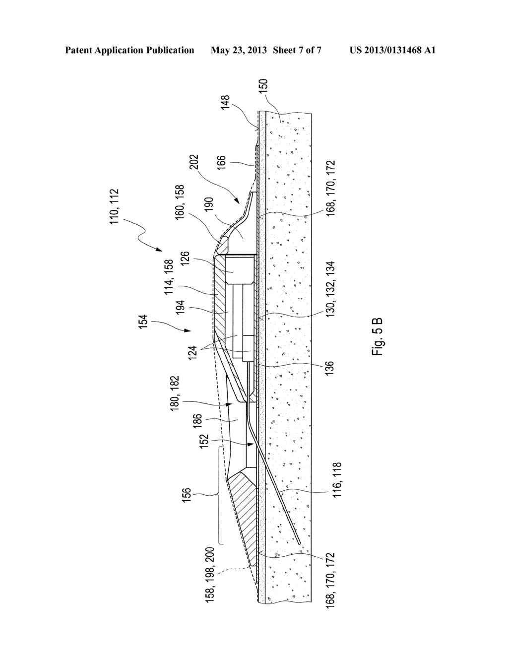 MEDICAL DEVICE COMPRISING A MULTIPART HOUSING - diagram, schematic, and image 08