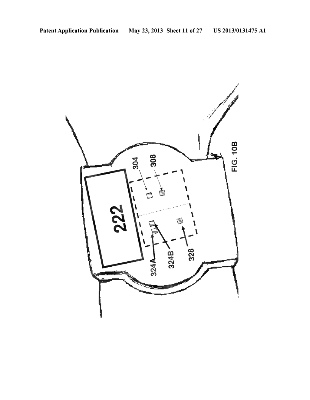 PHOTOPLETHYSMOGRAPHY DEVICE AND METHOD - diagram, schematic, and image 12