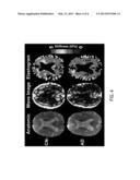 System and Method for Determining The Presence of a Neurodegenerative     Disease Using Magnetic Resonance Elastography diagram and image