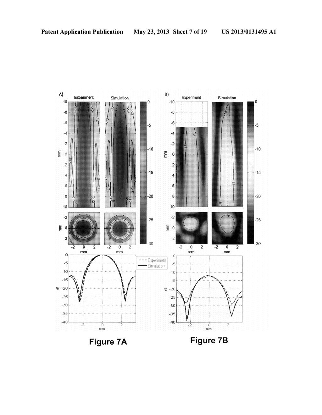 PLANNING SYSTEM FOR TARGETING TISSUE STRUCTURES WITH ULTRASOUND - diagram, schematic, and image 08