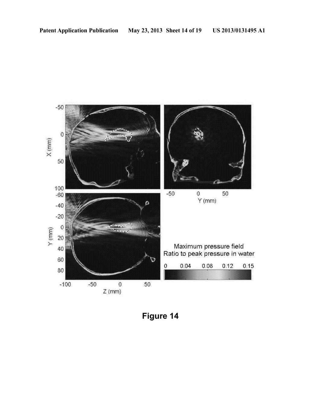 PLANNING SYSTEM FOR TARGETING TISSUE STRUCTURES WITH ULTRASOUND - diagram, schematic, and image 15