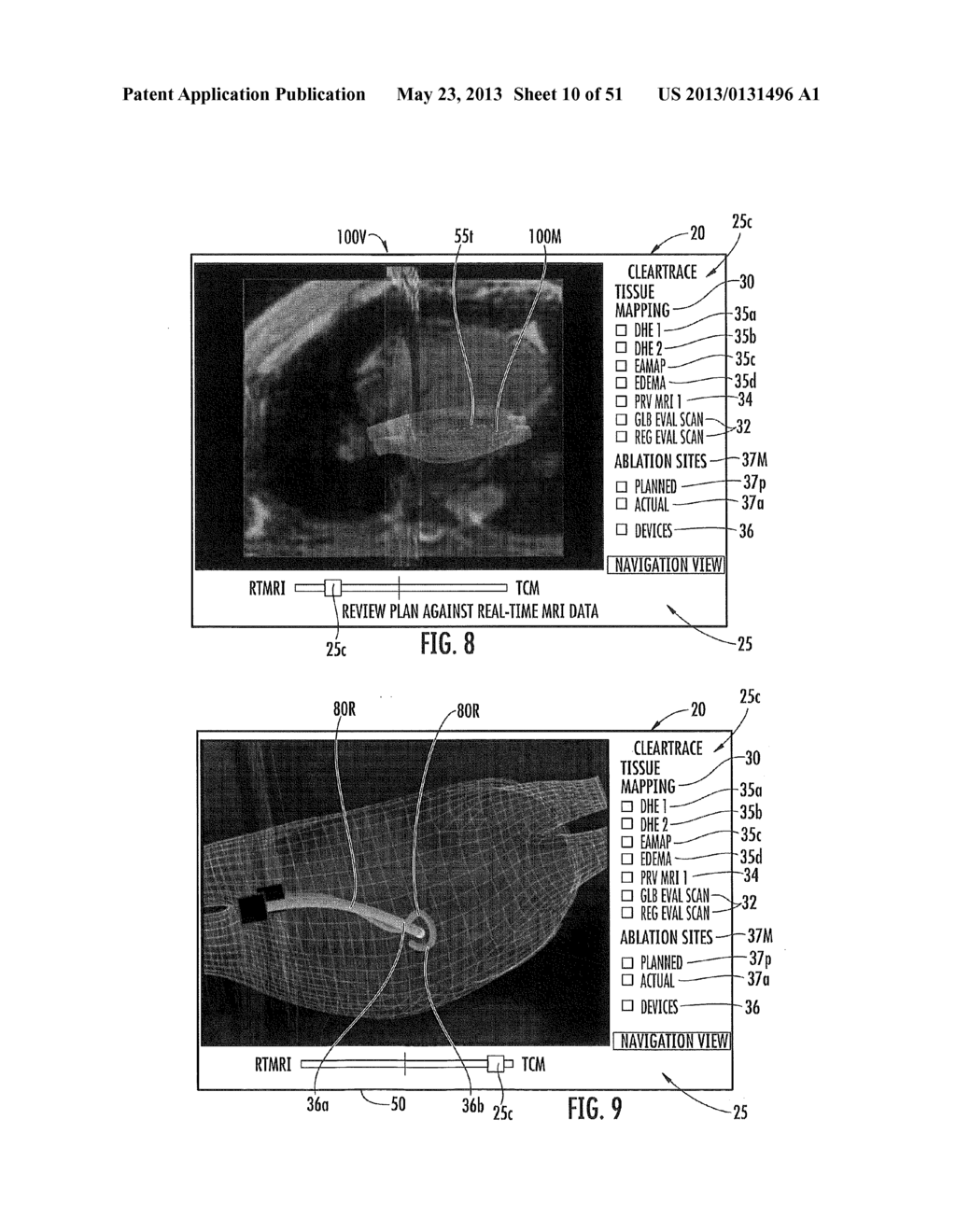 MRI-GUIDED CATHETERS - diagram, schematic, and image 11