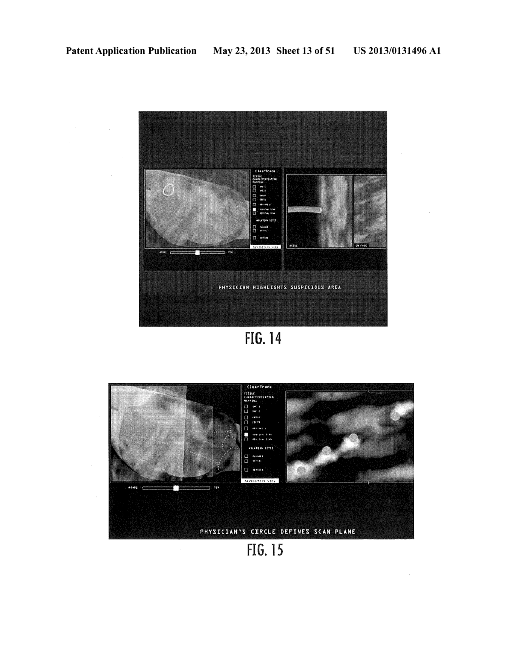 MRI-GUIDED CATHETERS - diagram, schematic, and image 14