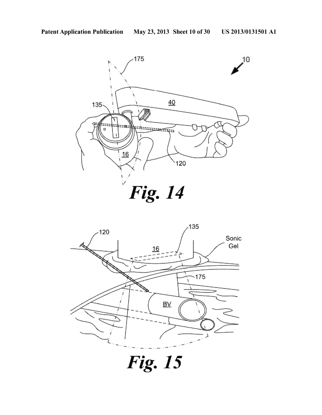 NEURO-VASCULATURE ACCESS SYSTEM AND DEVICE - diagram, schematic, and image 11